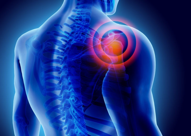How to Prevent Shoulder Injuries